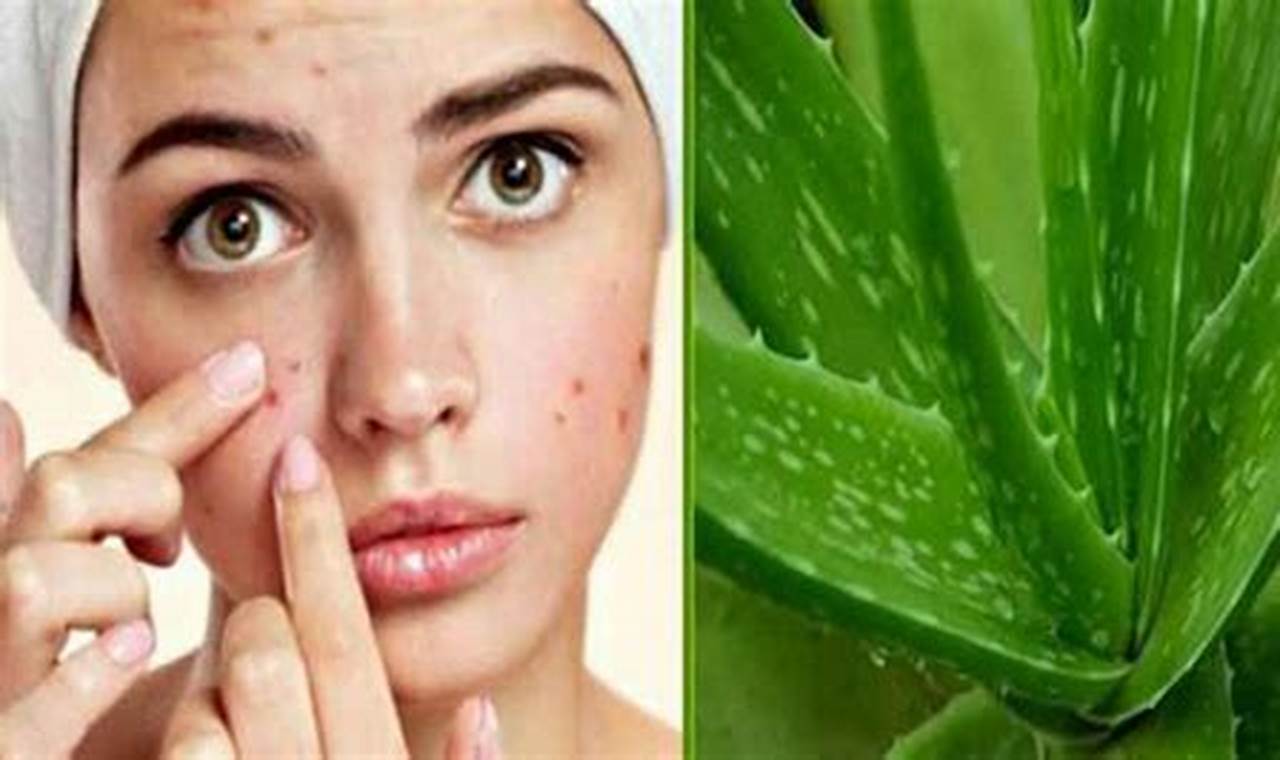 cara mengatasi jerawat secara alami